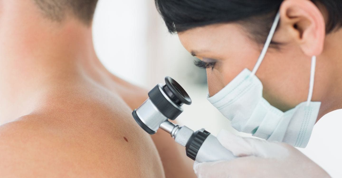 Melanoma: il vaccino su misura funziona, possibile svolta nelle cure (costi permettendo)