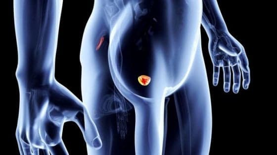 Tumore prostata, un nuovo test potrebbe sostituire la biopsia