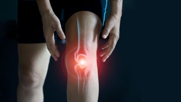 Il caldo può danneggiare cartilagini e articolazioni: ecco perché e cosa fare