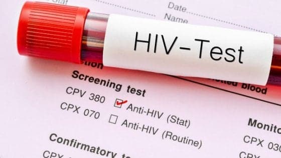 Aids, domenica test rapidi Croce rossa nelle piazze