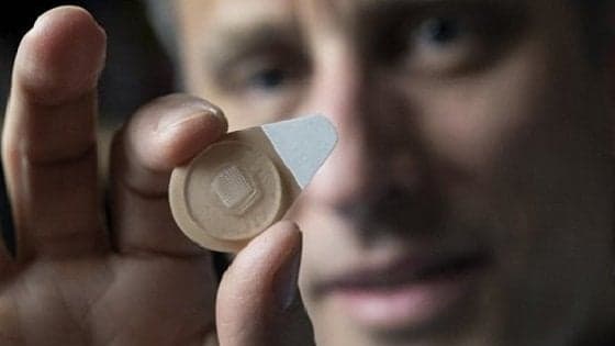 Contraccezione: progettato un cerotto ad azione prolungata