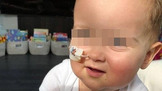 È riuscito il trapianto su Alex, il bimbo sta per essere dimesso