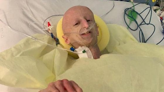 San Camillo, primo intervento al mondo sul cuore invecchiato di Sammy Basso