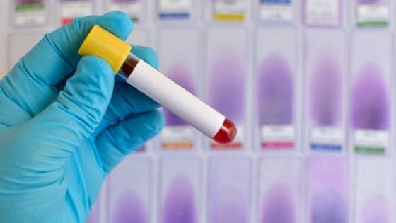 Individuato il freno a mano dell’epatite B