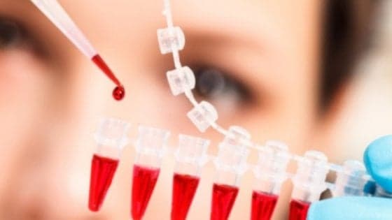 Tumori, uno su tre viene scoperto per caso