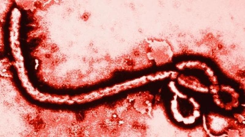 Sospetto Ebola, isolato a Cagliari un paziente rientrato dalla Repubblica Democratica del Congo