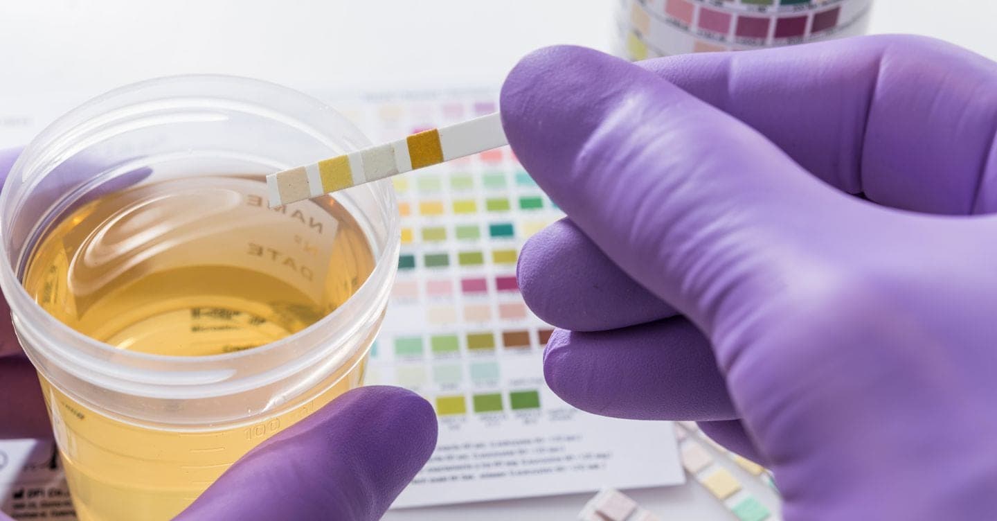 Doping: così il letrozolo maschera l’uso di anabolizzanti e accresce la resistenza