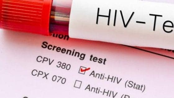 "Rompiamo il silenzio sull’Hiv" per fermare i nuovi contagi
