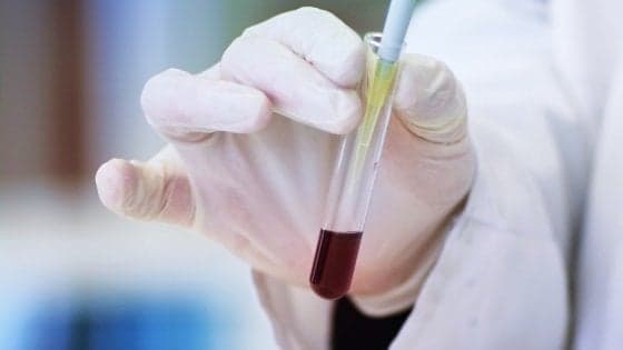 Donare il midollo osseo: il regalo che può salvare la vita