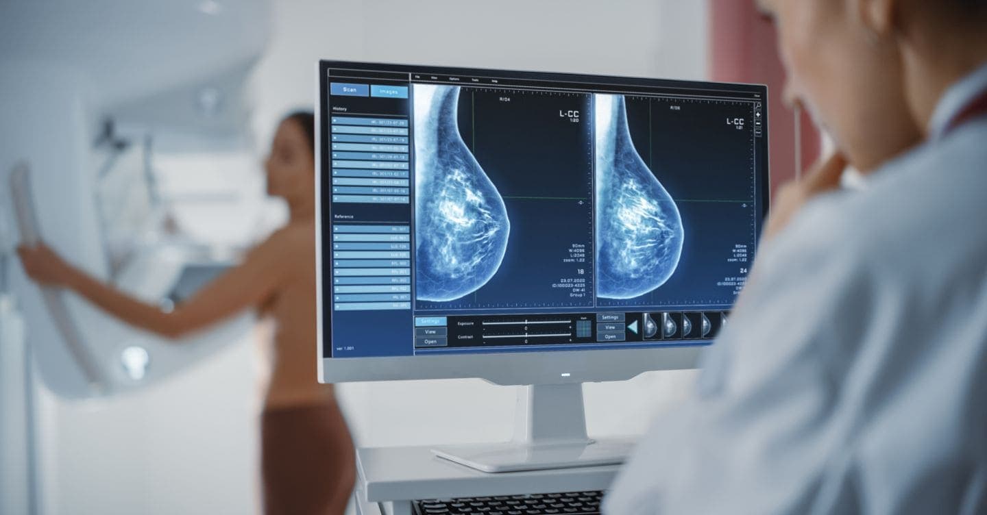Cancro al seno, una nuova strategia per prevenire le recidive