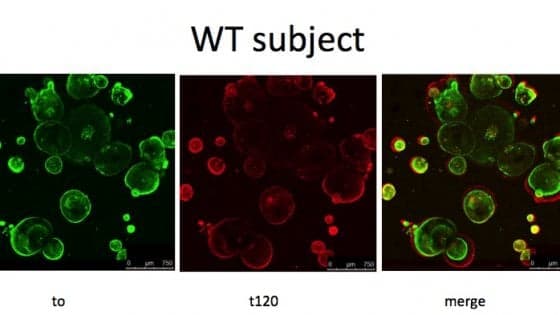 Un nuovo gel consente di creare organoidi adatti a uso umano