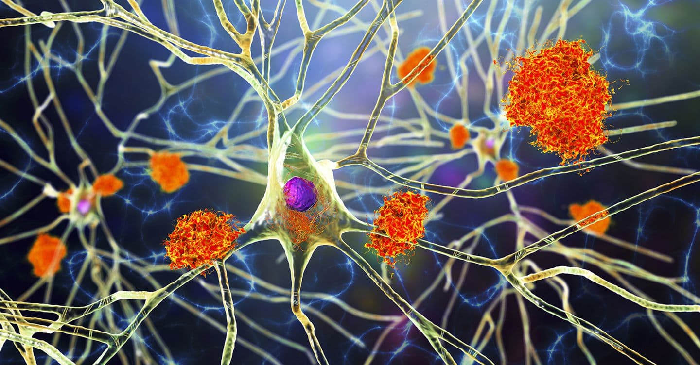 Riparare la barriera del cervello: così i ricercatori hanno invertito l’Alzheimer nei topi