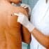 Melanoma, l’immuno-oncologia è efficace in fase “precoce”